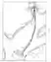 Fig. 10 - Systems and methods for real-time biopsy needle and target tissue visualization