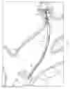 Fig. 12 - Systems and methods for real-time biopsy needle and target tissue visualization