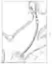 Fig. 13 - Systems and methods for real-time biopsy needle and target tissue visualization