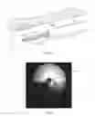 Fig. 10 - Systems and methods for eccentric nodule tissue acquisition