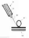 Fig. 01 - Two-endoscope technique of endoscopic mucosal resection and kit with a set of endoscopes for the method