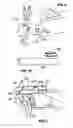 Fig. 10 - Apparatus and method for tissue closure
