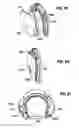 Fig. 16 - Apparatus and method for tissue closure