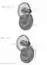 Fig. 48 - Applicator instruments with reconfigurable handles for dispensing surgical fasteners