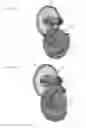 Fig. 49 - Applicator instruments with reconfigurable handles for dispensing surgical fasteners
