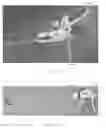 Fig. 03 - Methods of using applicator instruments having insertable, changeable cartridges for dispensing surgical fasteners