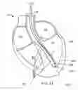 Fig. 35 - Multi-window guide tunnel
