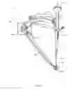 Fig. 02 - Surgical drill guide system with articulating guide adaptor