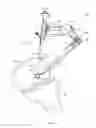 Fig. 09 - Surgical drill guide system with articulating guide adaptor