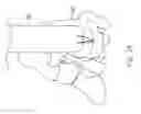 Fig. 22 - Transosseous guide and method
