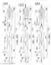 Fig. 110 - Clot retrieval system