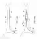 Fig. 47 - Clot retrieval system