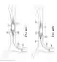 Fig. 48 - Clot retrieval system