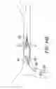 Fig. 49 - Clot retrieval system