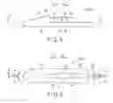 Fig. 05 - FORCEPS-TYPE TREATMENT INSTRUMENT