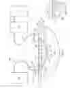 Fig. 02 - Disruptive dressing for use with negative pressure and fluid instillation