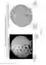 Fig. 09 - Disruptive dressing for use with negative pressure and fluid instillation