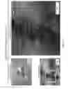 Fig. 10 - Disruptive dressing for use with negative pressure and fluid instillation