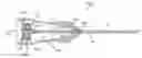 Fig. 01 - Medical Tool for Reduced Penetration Force