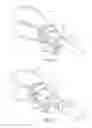 Fig. 11 - Trocar set