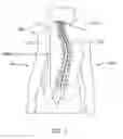 Fig. 02 - Non-invasive adjustable distraction system
