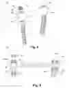 Fig. 07 - Press-on pedicle screw assembly