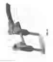 Fig. 02 - Spondylisthesis reduction system