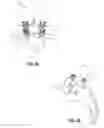 Fig. 04 - Spondylisthesis reduction system