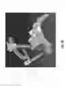Fig. 12 - Spondylisthesis reduction system