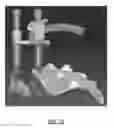 Fig. 16 - Spondylisthesis reduction system