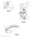 Fig. 27 - Spondylisthesis reduction system