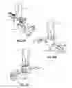 Fig. 28 - Spondylisthesis reduction system