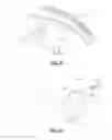 Fig. 32 - Spondylisthesis reduction system