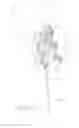 Fig. 35 - Systems and methods for joint replacement
