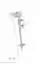 Fig. 49 - Systems and methods for joint replacement