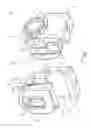 Fig. 08 - Surgical band clamp system