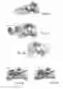 Fig. 06 - Orthopedic dual pocket compression plate and method of surgery