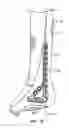 Fig. 03 - Ankle tibia plates