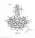 Fig. 05 - Ankle tibia plates