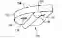 Fig. 01 - Orthopaedic implant with fixation feature and a method of implanting thereof