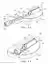 Fig. 07 - Orthopaedic implant with fixation feature and a method of implanting thereof