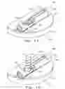 Fig. 08 - Orthopaedic implant with fixation feature and a method of implanting thereof