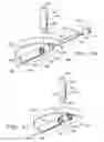 Fig. 09 - Orthopaedic implant with fixation feature and a method of implanting thereof