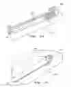 Fig. 13 - Orthopaedic implant with fixation feature and a method of implanting thereof