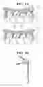 Fig. 02 - Longitudinally-adjustable bone anchors and related methods
