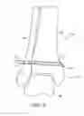 Fig. 06 - SURGICAL PROCEDURE