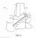 Fig. 09 - SURGICAL PROCEDURE