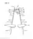 Fig. 03 - APPARATUS FOR ABLATION OF BODY TISSUE AND METHOD OF USE THEREOF