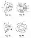 Fig. 03 - Implant device and system for ablation of a vessel's wall from the inside