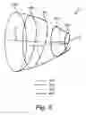 Fig. 04 - Implant device and system for ablation of a vessel's wall from the inside